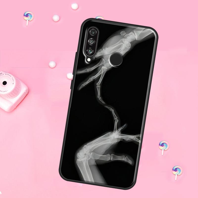xray art aesthetic Skull For Huawei Nova 10 9 SE 3i 7i 8i 11i 12i Y73 Y90 Y70 Y72 Y61 Y91 P60 Pro P30 P40 Lite Case