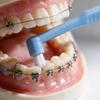 Manual Orthodontic Toothbrush With Soft Bristles For Whole Family Dental Cleaning