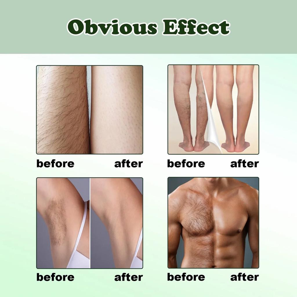 Removedor de cabello Spray indoloro inhibidor del crecimiento del cabello pierna brazo axila cuerpo depilatorio permanente nutrir reparación suavizar el cuidado de la piel