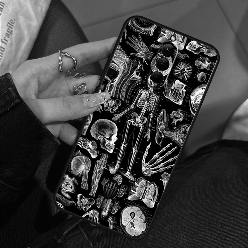 

Medical Skeleton Anatomy Case For ZTE Nubia RedMagic 11 Air 8 9 10 8S 9S 10S Pro Plus 5G 5S 6 7 6S 7S Pro 10 Air Cover Red Magic 5G