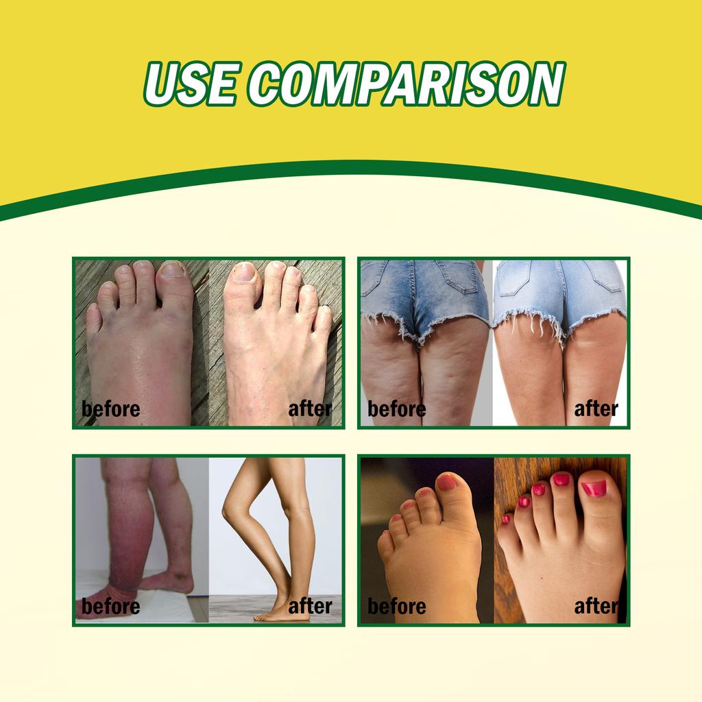 Entschwellende und entgiftende Salbe, entfettend und straffend, lymphatische Entgiftung und Lymphpflege-Salbe, Linderung von Schmerzen und Müdigkeit