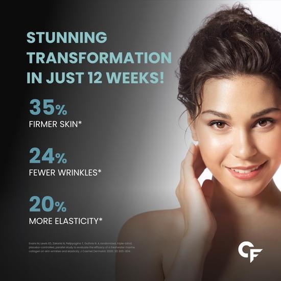 Carbamide Forte Collagen Supplements | Hydrolyzed Collagen Powder for Women & Men | Hydrolyzed Collagen Peptides Powder - 200g