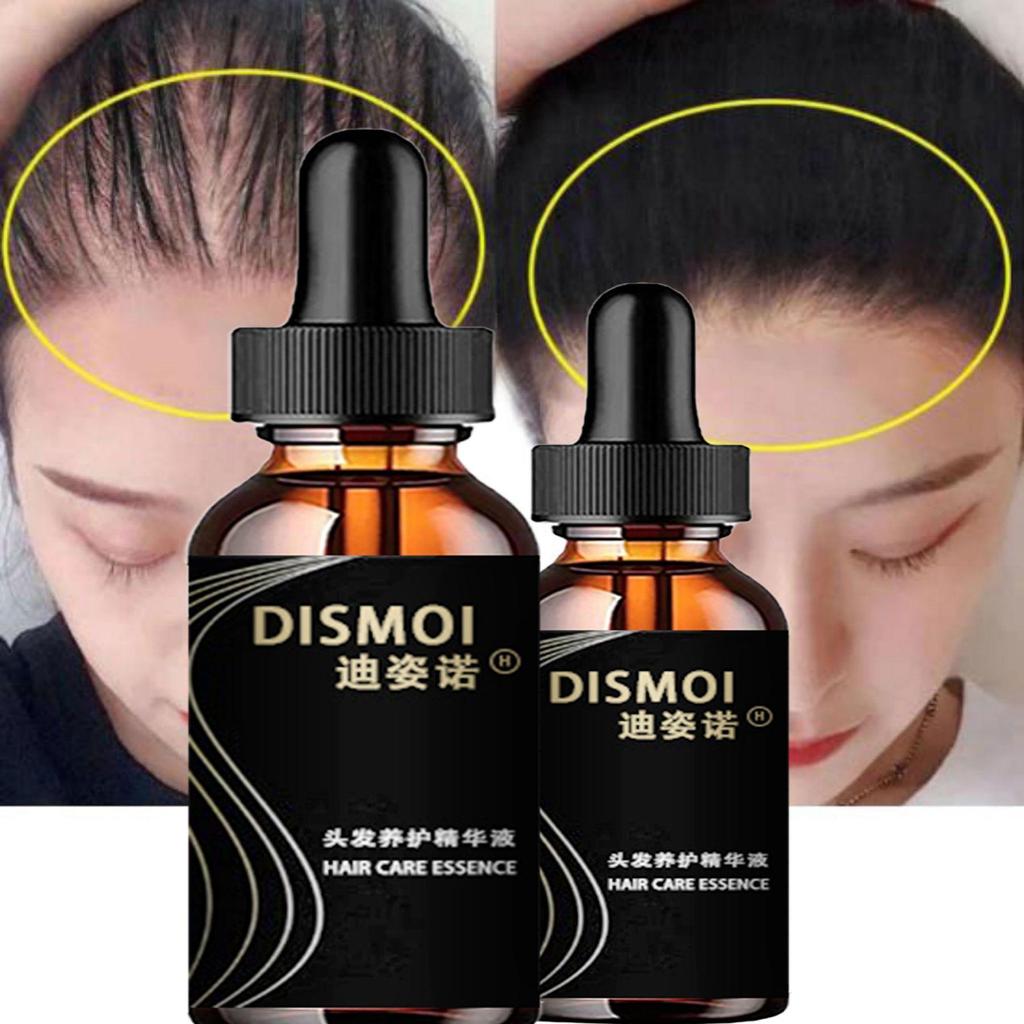 Anti-Alopezie-Haarwachstumsserum, ätherisches Öl, Anti-Haarausfall-Spray-Produkte, Ingwer-Behandlung, trockenes, krauses, beschädigtes Haar