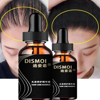 Sérum Anti-alopécie pour la croissance des cheveux, huile essentielle, produits en Spray Anti-perte de cheveux, traitement au gingembre, secs, crépus et endommagés