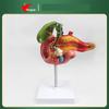 Human Pancreas Duodenum Gallbladder Pathological Model