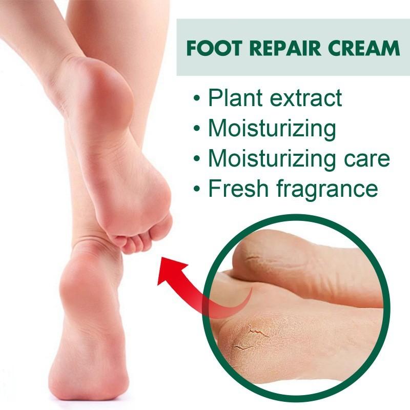 Ouhoe Nourishing Foot Repair Cream For Cracked Heels Dry Skin And Hydration 100g