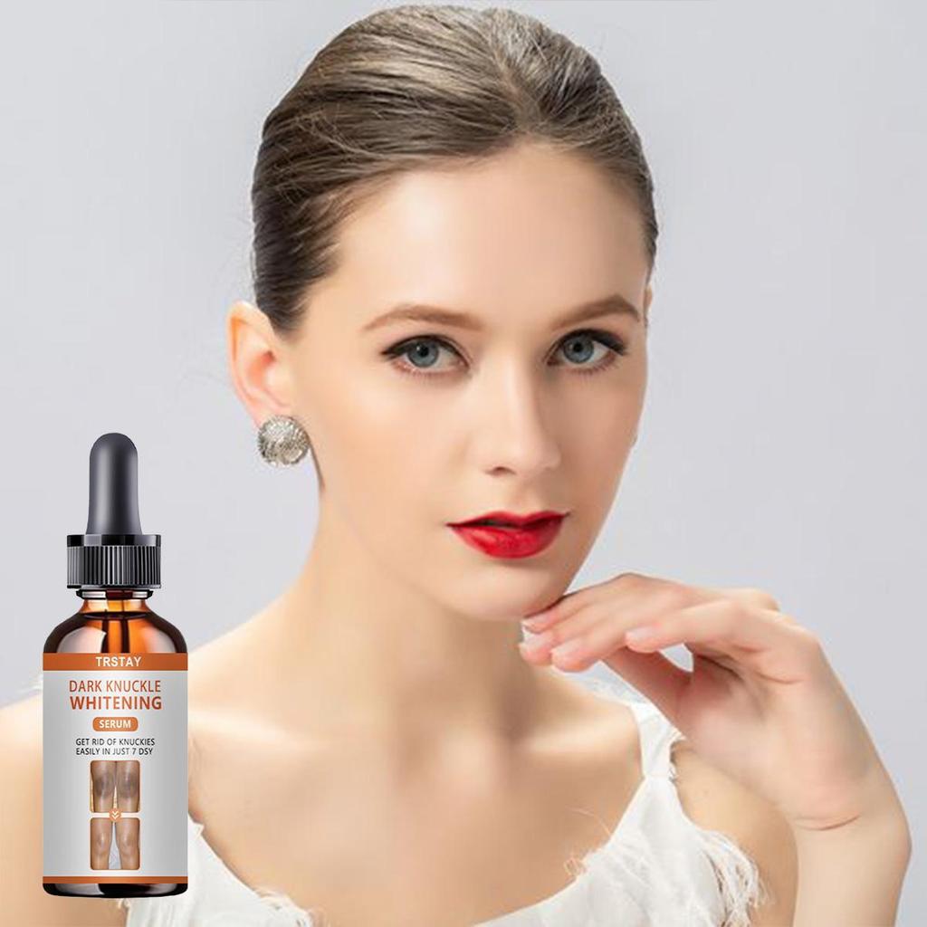 Whitening Freckles Cream Remove Melasma Dark Spot Lightening Melanin Brightening Melasma Remover Moisturize Anti-aging Face Care