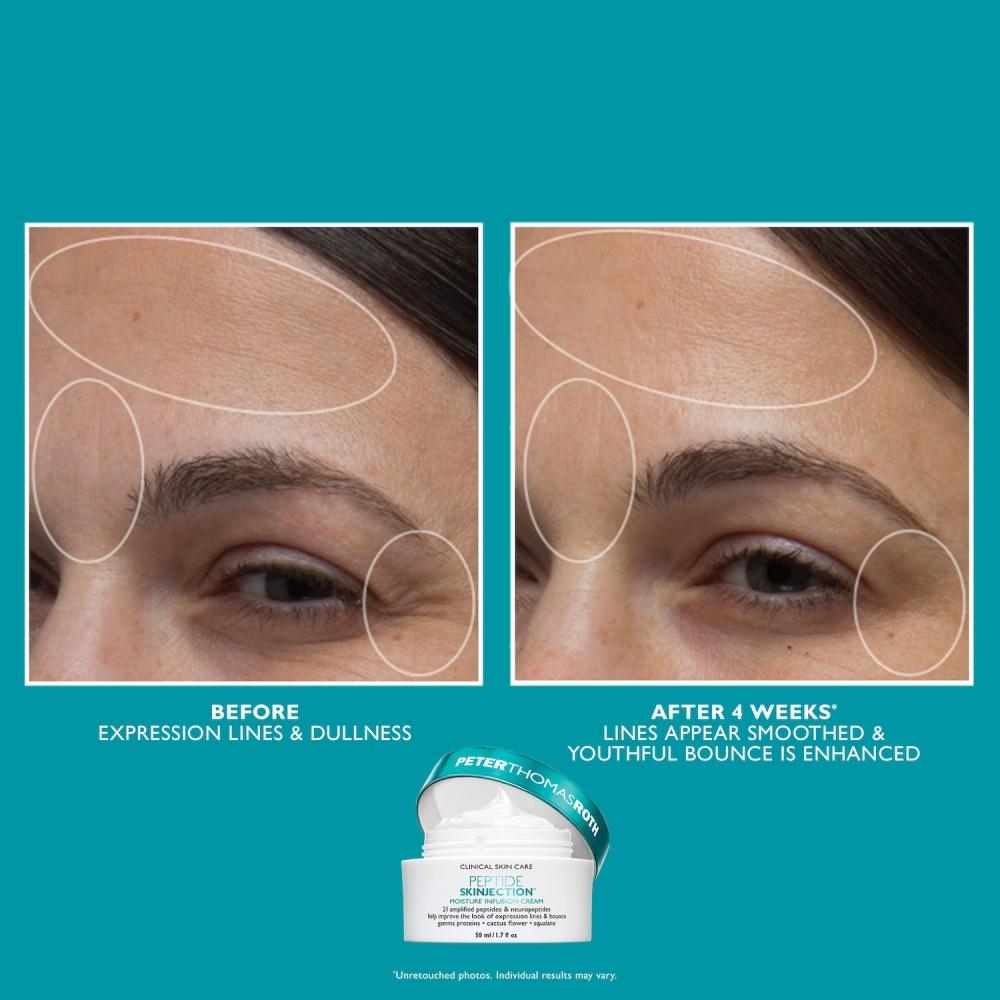 Peter Thomas Roth Peptide Skinjection  Set With Under Eye Cream And Moisturizer