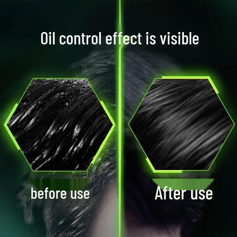 Clear Men Scalp Energizing Anti-Dandruff Shampoo