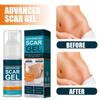 Scar Gel for Face Body Skin Care Scar Treatment for Both Old And Scars 50ml Make Scars Smaller & Less Visible Body Creams