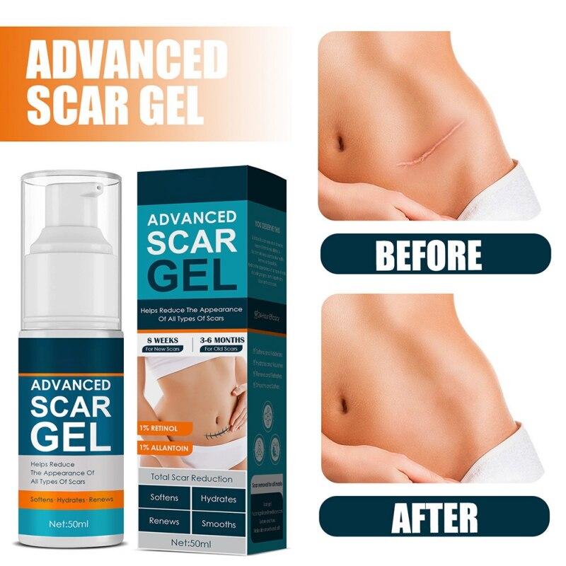 Scar Gel for Face Body Skin Care Scar Treatment for Both Old And Scars 50ml Make Scars Smaller & Less Visible Body Creams