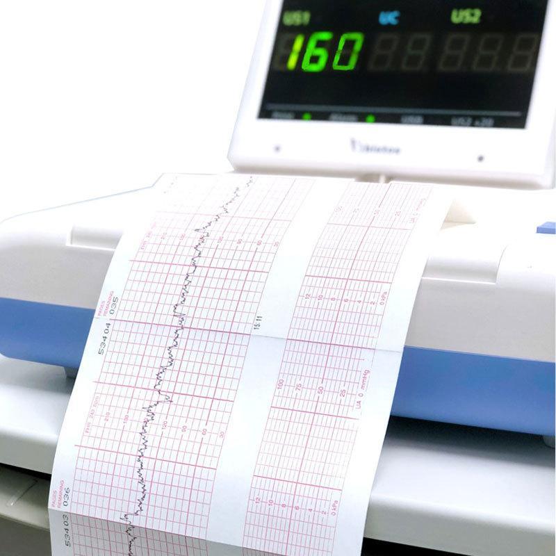 Electrocardiograph Printer Paper Thermal Ecg Paper Clear Accurate Grid High Sensitivity For Hospital Medical Use 50/63/80/110Mm