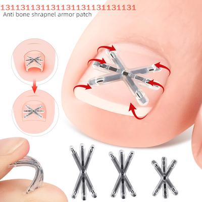 2 Pcs Ingrown Toenail Correction Tool Ingrown Toenail Treatments Elastic Patch Sticker Toenail Straightening Pedicure Tools