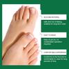 Toe Corrector, Hallux Valgus Separator, Separate And Overlap Hallux Valgus Corrector.
