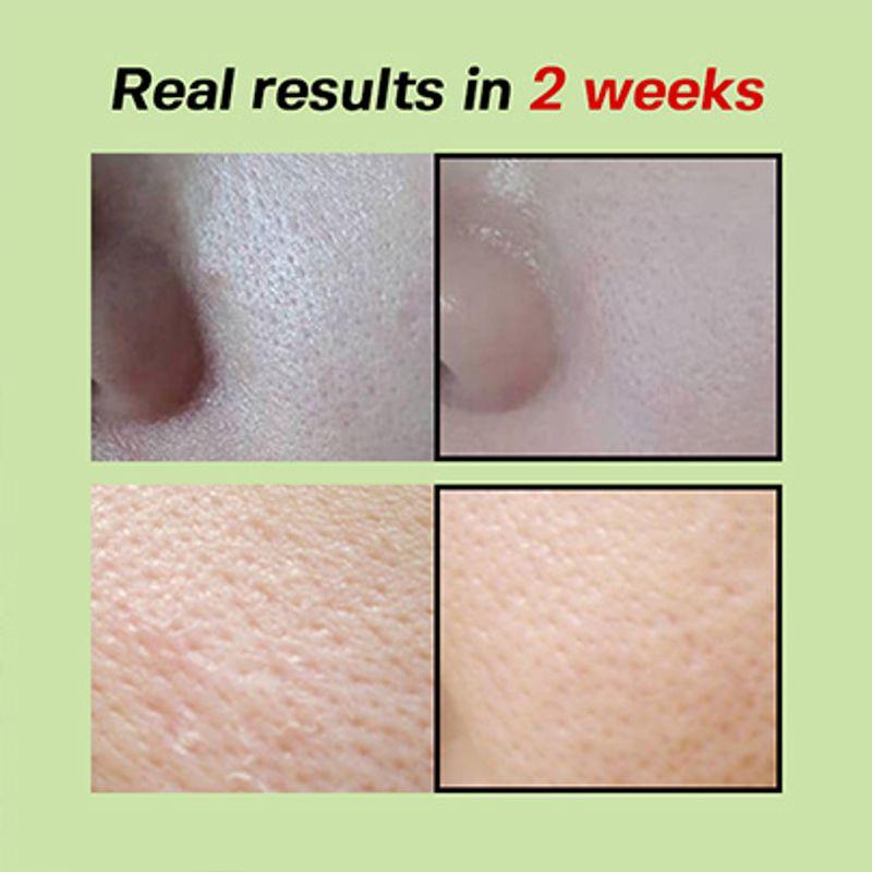 SUNGBOON EDITOR Green Tomato Pore Lifting Ampoule+ 30ml