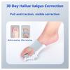 Device for correcting hallux valgus
