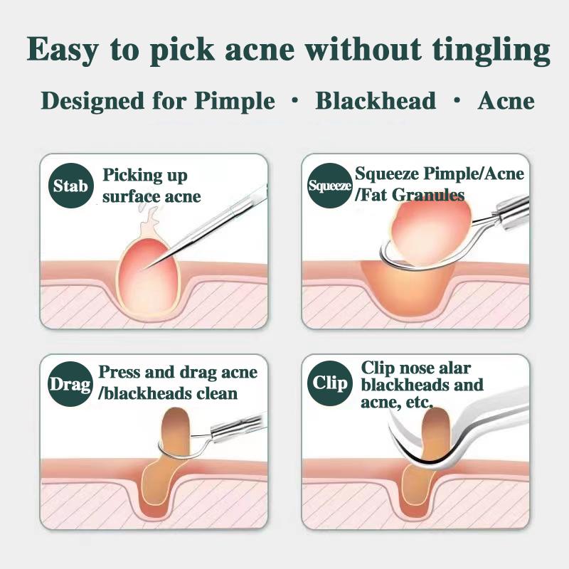 Xiaomi Acne Needle Blackhead Cell Clip Suit Double-Headed Acne Needle Acne Acne Removal Needle Tweezers Precision Acne Clip Acne Tool