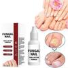 Nail Repair Solution 15ml Deep Nourishing Cuticle Treatment For Strong Glossy Nails Fast Absorbing Non Sticky Portable Care