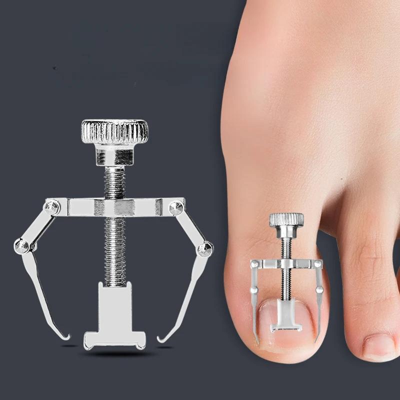 Nail Straighten Clip Ingrown Toenail Corrector Foot Nail Care Stainless Steel Pedicure Tools Treatment Health Care Toe Corrector