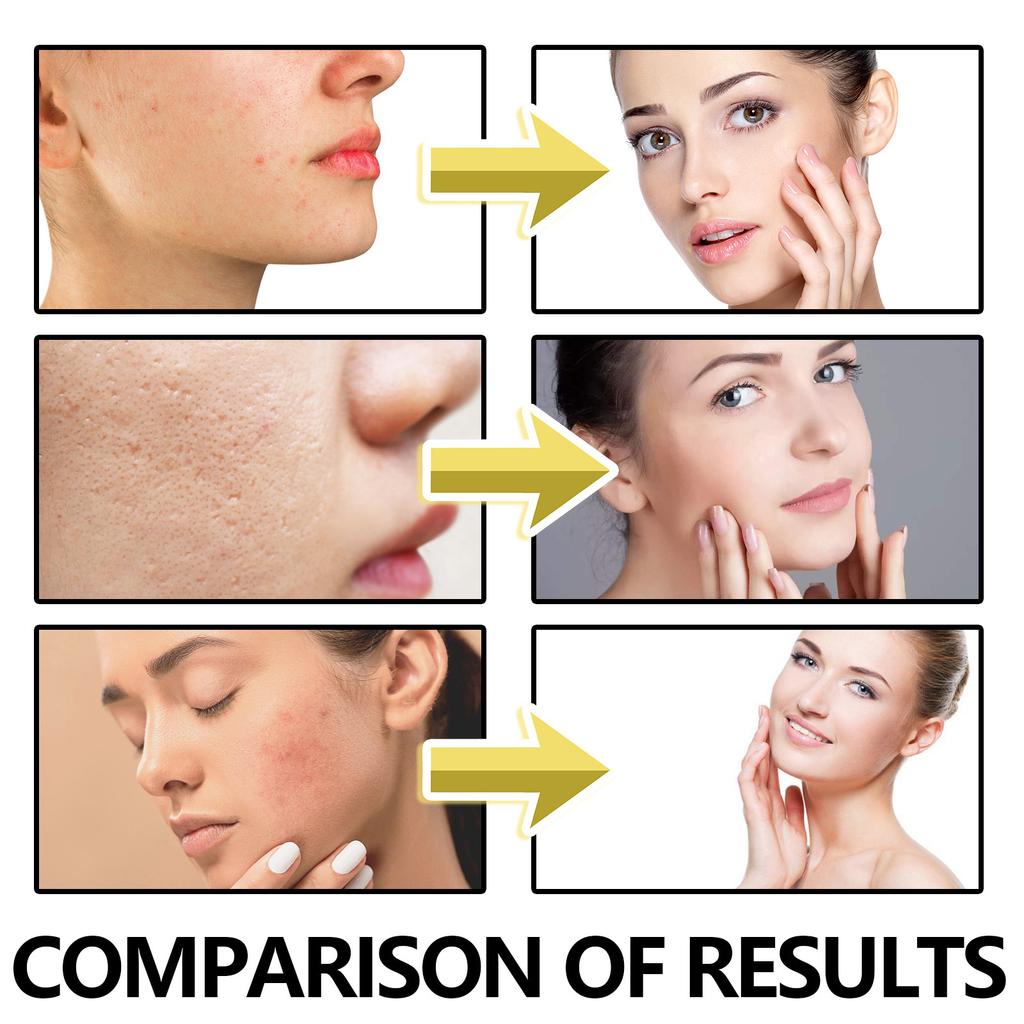 EELHOE Anti-Aging Remove Wrinkle Firming Lifting Whitening Brightening Moisturizing Facial Skin Care Retinol Face Cream 50g