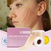 Silicone Scar Patch 4x150cm Waterproof Keloid Removal Strip Effective Scar Therapy Self-Adhesive Tape for Surgical Acne Burn