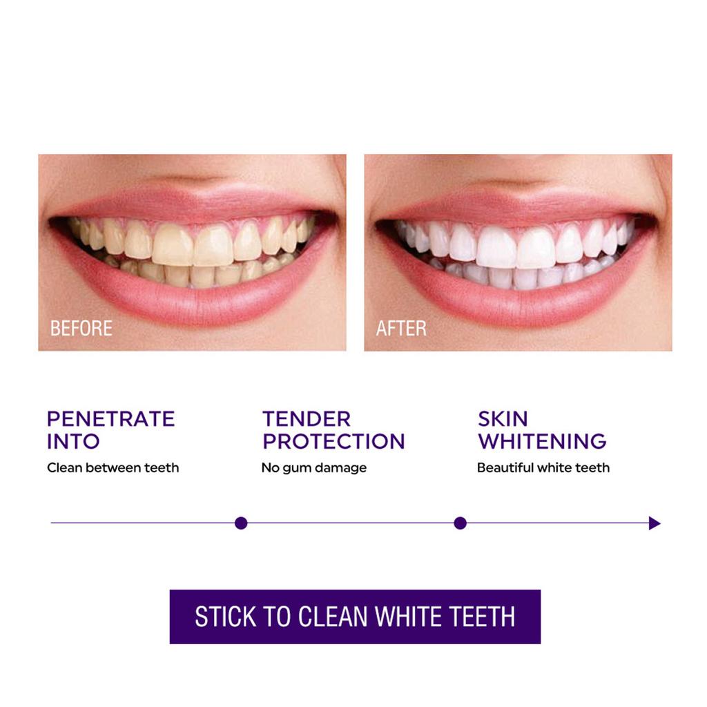Antiallergic Brightening Toothpaste, Gentle Cleaning for Sensitive Teeth and Fresh Breath, Helps Whiten Teeth