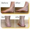 Orthoflexx Arch Support Orthotics, Orthoflexx Insoles For Men, High Arch Support