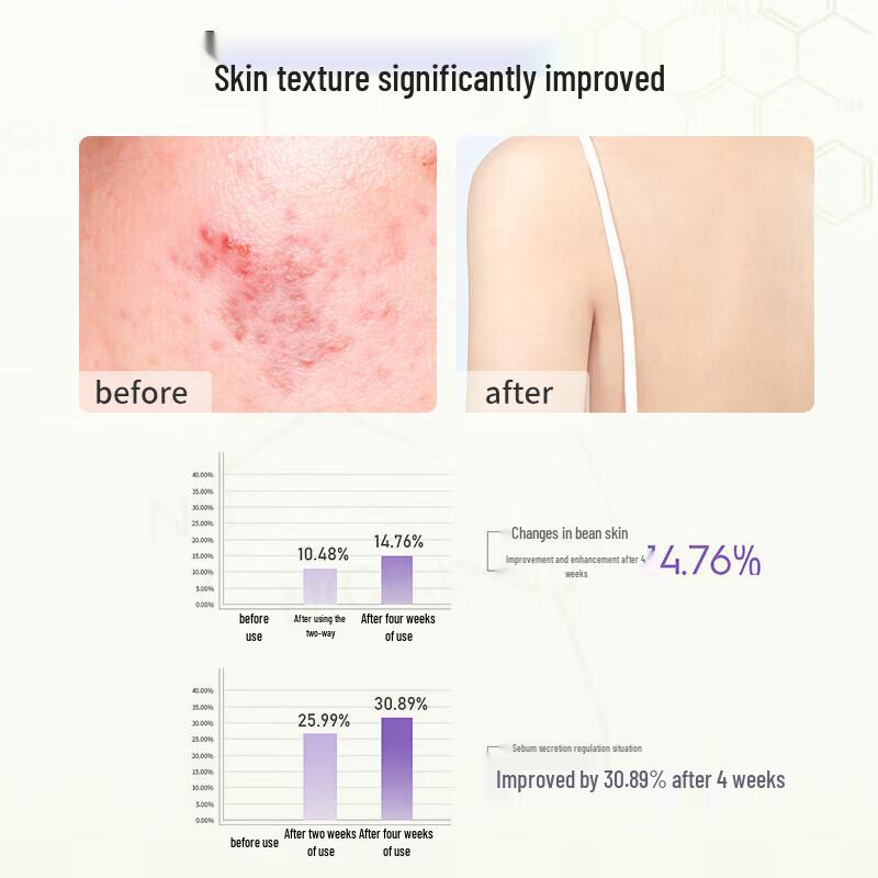 Seagilon Amino Acid Oil Control & Acne Clear Shower Gel