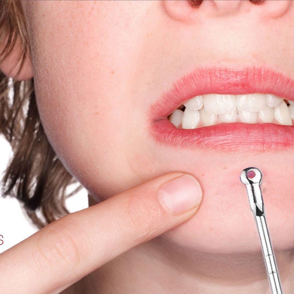 7 Pcs Pimple  Comedone Acne Extractor Remover Tool Set