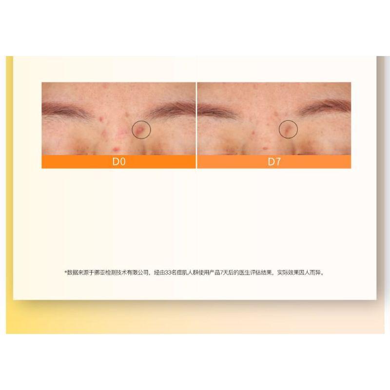 John Jeff - 20% Azelaic Acid Cream