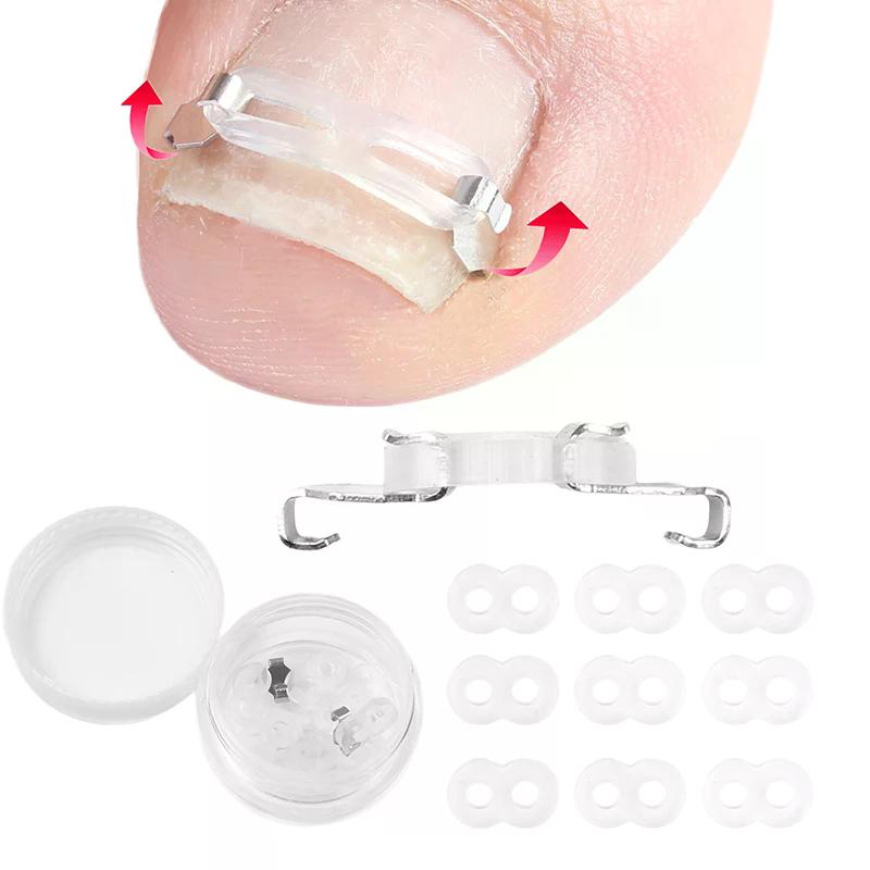 Set Tool 1/2 Ingrown Toenail Corrector Pedicure Recover Embed Treatment Professional Foot Care Correction