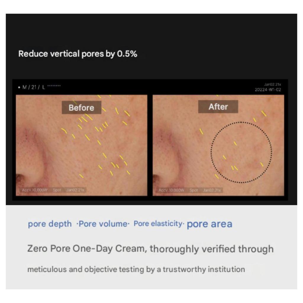 Medicube Zero Pore One-Day Cream (50 Ml) (3 Options)