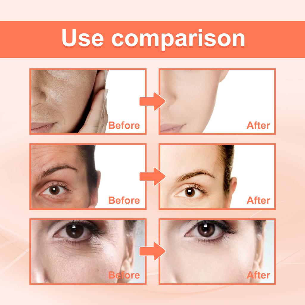 EELHOE Rose Oil VC Moisturizing Essence Face Firming Hydration Anti-Wrinkles Aging Wrinkles Headlines