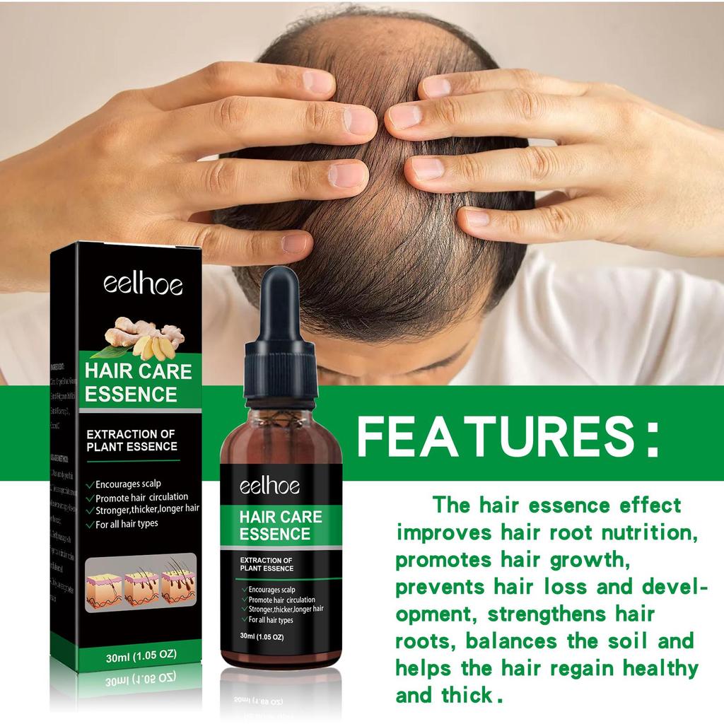 EELHOE Ginger Hair Growth Serum (30ml) - Anti-Hair Loss, Healthy Beauty, Hair Care Oil, Hair Thickening Growth Essence