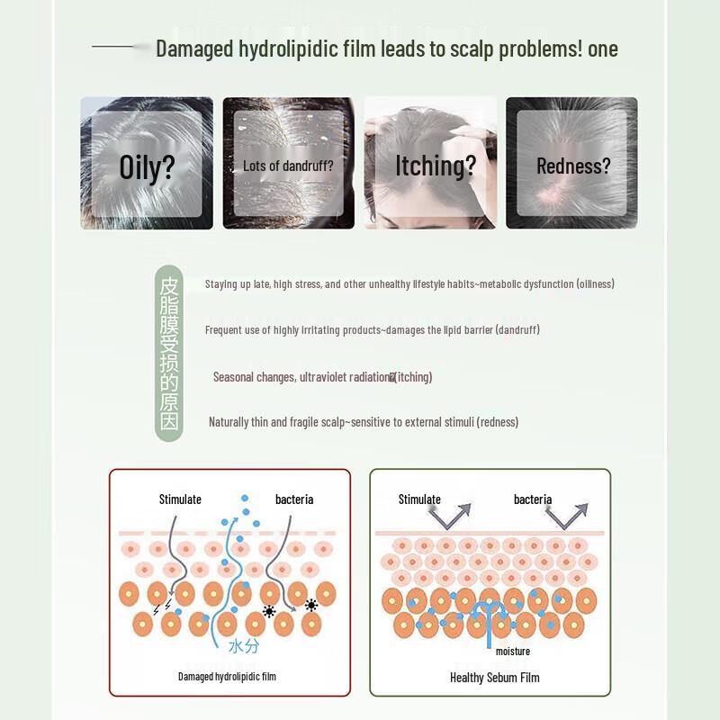 Sunsilk Oil Control Anti-Dandruff Shimmering Shampoo