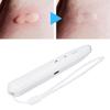 Portable Mosquito Insect Bite Relieve Itching Pen Rechargeable Natural Bug Insect Bite Itch Relief Heat Pen for Adult Children