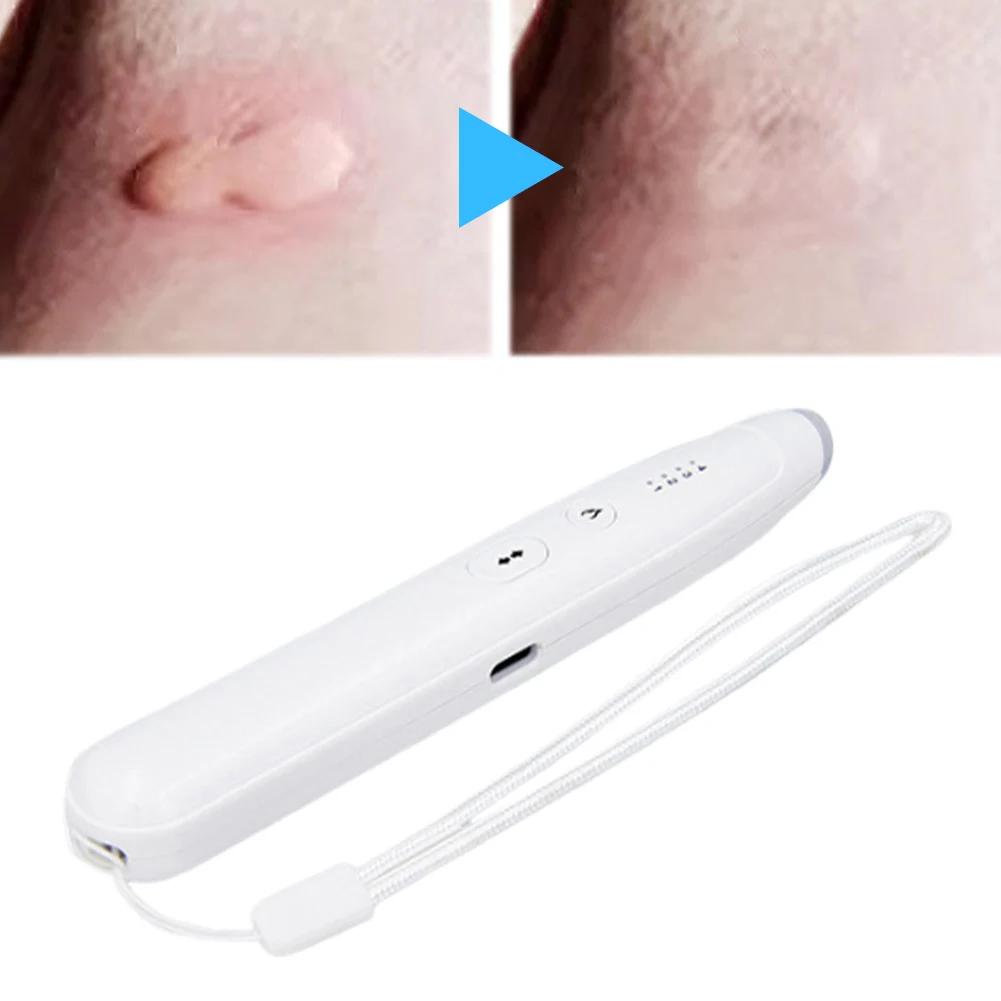 Portable Mosquito Insect Bite Relieve Itching Pen Rechargeable Natural Bug Insect Bite Itch Relief Heat Pen for Adult Children