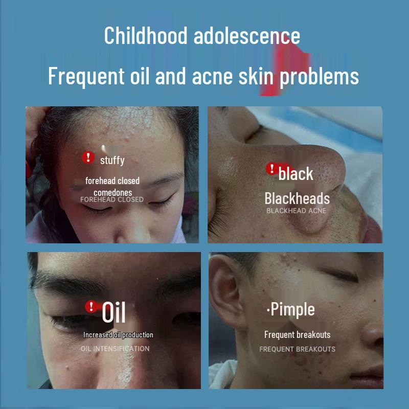 HIEUAILR Amino Acid Teenage Facial Cleanser