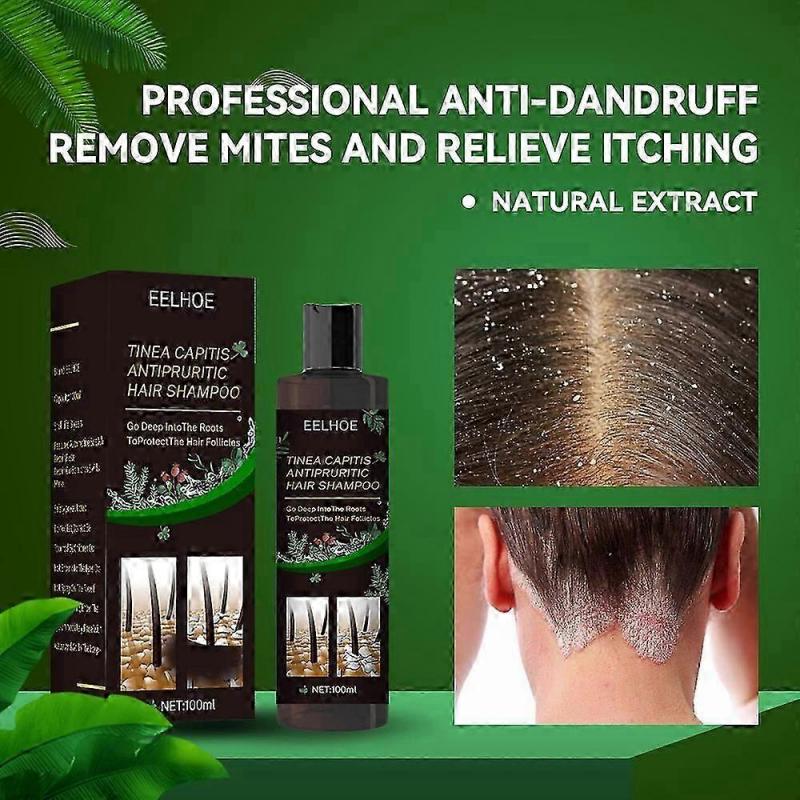 100ml Scalp Ringworm Anti-itch Shampoo Dandruff Control Oil Anti-itch Shampoo Anti-loss Oil Control Refreshing Shampoo