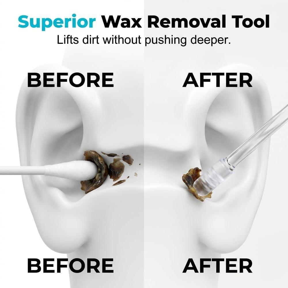 Sticky Ear Cleaning Sticks, Reusable Ear Cleaning Sticky Sticks (Size S) | 24 Sticky Earwax Cleaning Sticks with Soft Resin Tips (1 Pack)