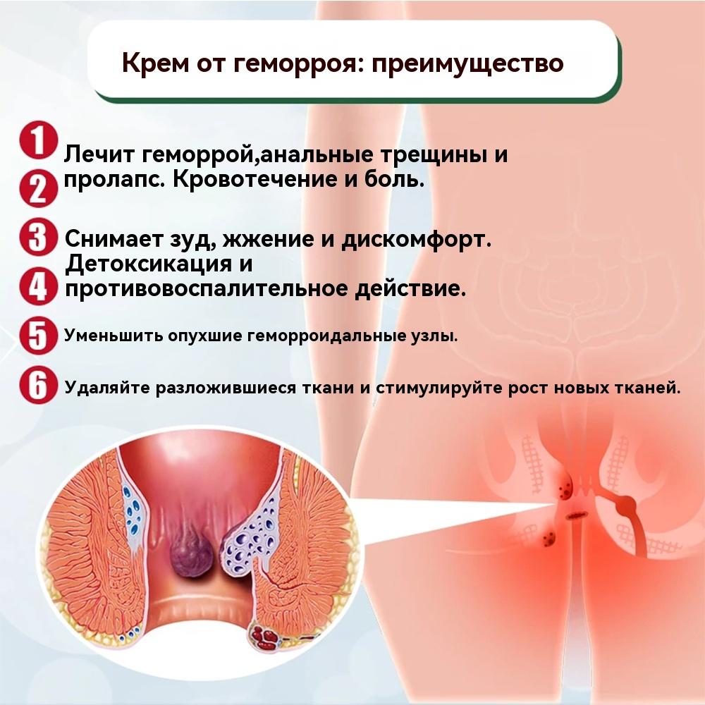 Hemorrhoid Ointment Hemorrhoid Care Cream Ointment For Male And Female Internal And External