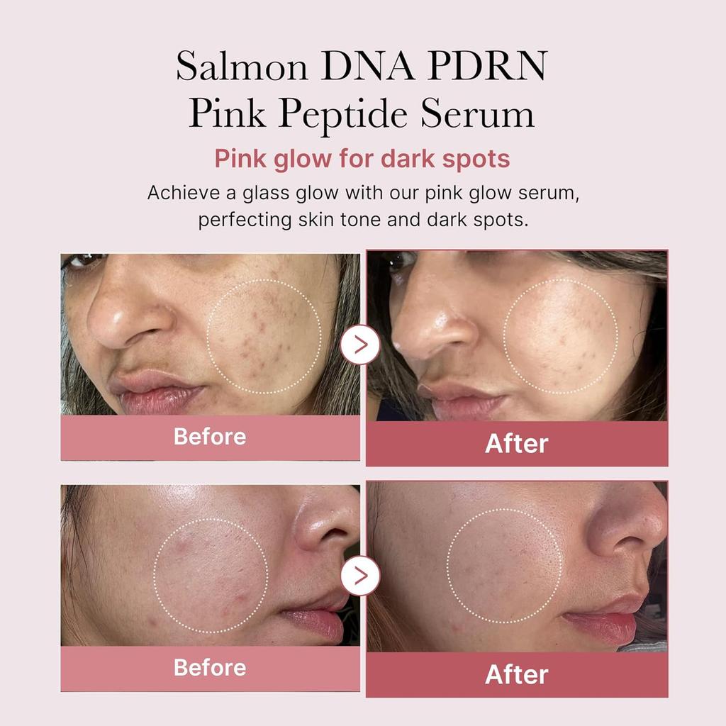 Medicube Über Nacht Erneuerung Lachs PDRN Duo – Pinkes Peptidserum + Kollagen Kapselcreme Set (30 ml + 50 ml)