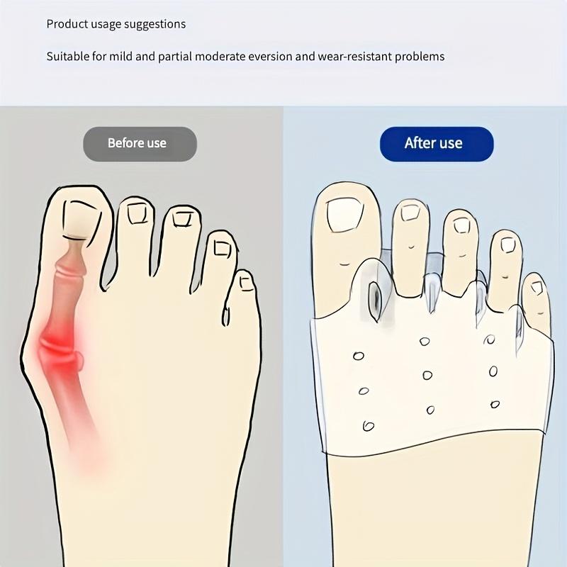 Hallux Valgus-korrigerare med tåseparerare, framfotskuddar för fem tår för silikonskor för kvinnor