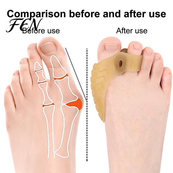 Foot Care Toe Separator 1 Pair for Overlapping Toes, Soft SEBS Bunion Corrector, Double Double-hole Spacer Hole Hallux Valgus, Breathable Straightener
