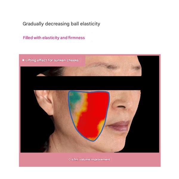 Mediheal Hyper Mask Collagen/Hyaluronic Acid 35g 10 Sheets (2 Options)