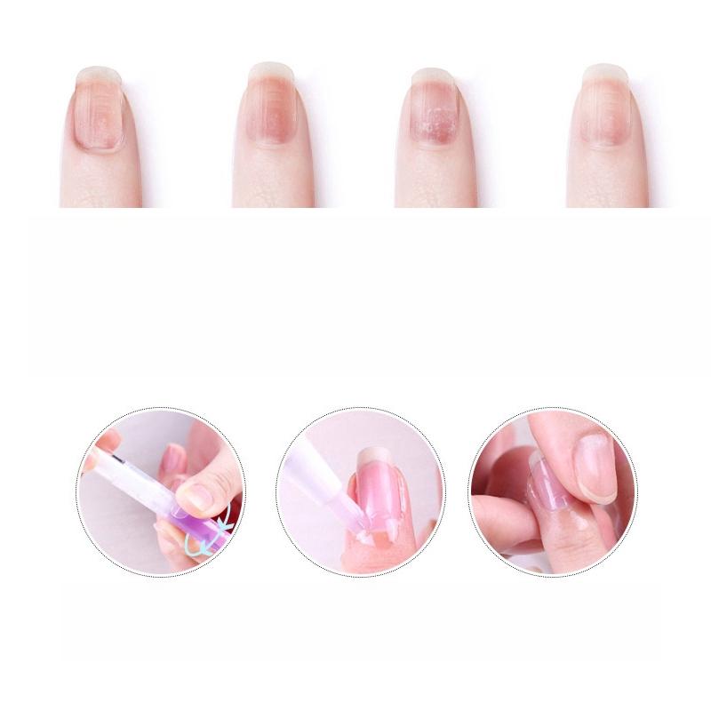 Nail Nutrition Pen Finger Edge Oil Nail Protector Repair Edge Moisturizing anti-Barb Treatment Solution To Remove Dead Skin Nail Tools Care Products