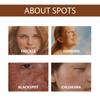 Hoygi Niacinamide Spot Brightening Serum Hydrating And Nourishing Skin Treatment For Dark Spots And Dull Complexion