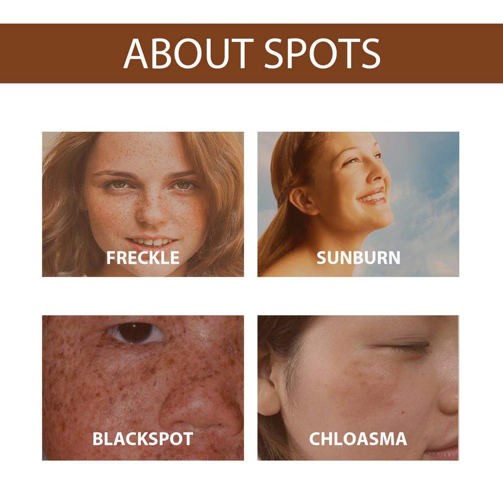 Hoygi Niacinamide Spot Brightening Serum Hydrating And Nourishing Skin Treatment For Dark Spots And Dull Complexion