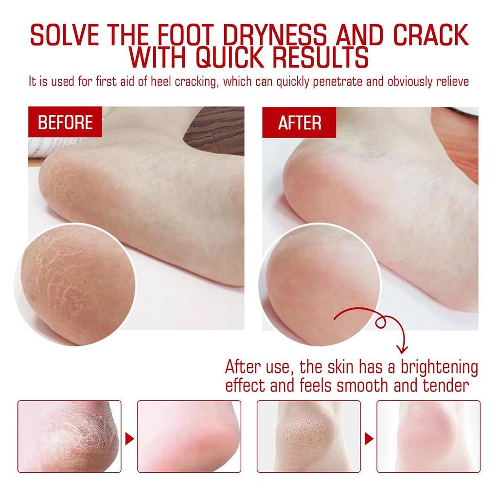 Nourishing Hand And Foot Mask Set With Moisturizing Foot Cream, For Smooth And Glowing Skin