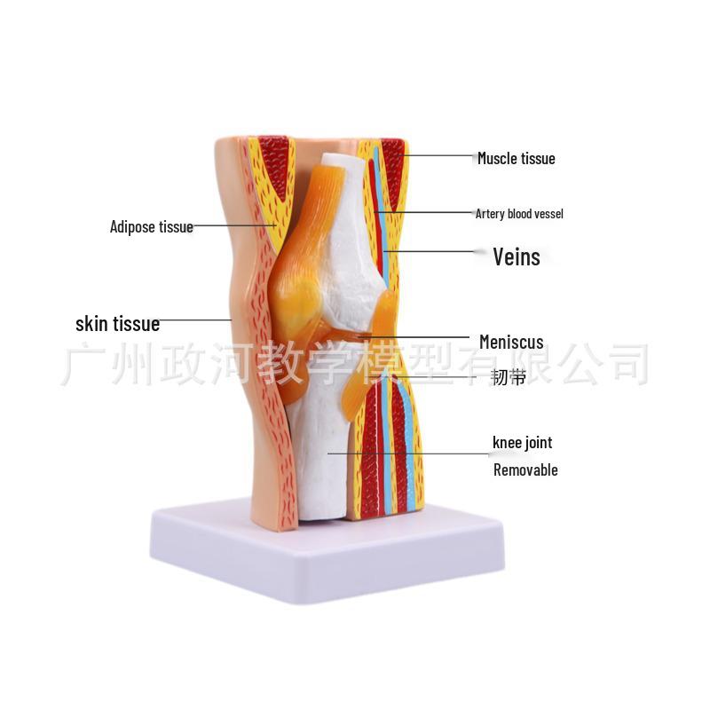 Removable Human Knee Joint Anatomy Model with Skin, Bones, Ligaments, and Meniscus for Medical Teaching